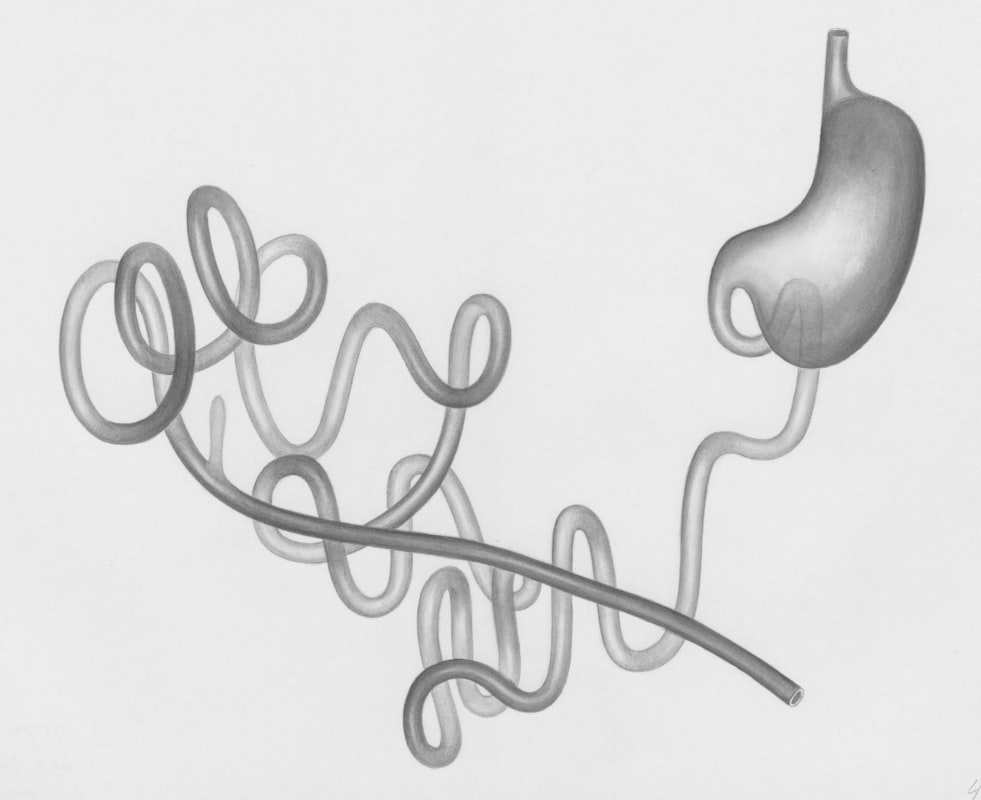 Permeabilidad intestinal: qué es, síntomas y cómo fortalecerla
